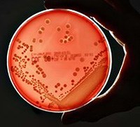 Điểm báo về các thông tin liên quan đến y tế ngày 12 & 13 tháng 8 năm 2010