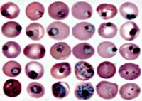 Một phương pháp mới đồng bộ hóa (synchronization) ký sinh trùng sốt rét Plasmodium falciparum