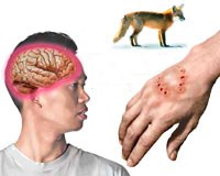 Xử trí khi bị chó cắn để phòng bệnh dại