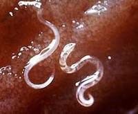 Tại sao giun đũa, giun tóc, giun móc gọi là giun truyền qua đất  và biện pháp phòng chống thế nào ?