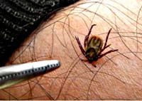 Bệnh sốt Q và bệnh Lyme là bệnh gì?
