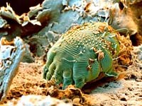 Ký sinh trùng-tác nhân gây bệnh “bị lãng quyên” nhưng lại là những kẻ thù nhỏ luôn ảnh hưởng đến sức khỏe con người