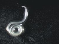 Tổng hợp các đặc điểm lâm sàng trên người do dị ứng với bệnh ký sinh trùng Anisakis