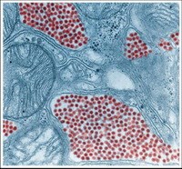 Điểm báo về các thông tin liên quan đến y tế ngày 4 & 5 tháng 11 năm 2010