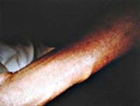 Loài “côn trùng lạ” mà không lạ