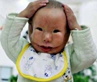 Từ những câu chuyện lạ trong y học đến các trường hợp sinh đẻ ly kỳ trên thế giới