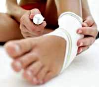 Bong gân và cách xử trí