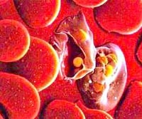 Sốt rét tiểu huyết cầu tố gây nguy cơ tử vong cao