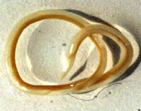 Ăn cá chưa nấu chín, coi chừng bị nhiễm giun Anisakis