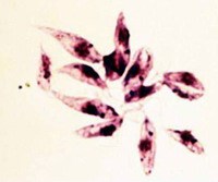 Tại Việt Nam có bệnh Leishmania không ?