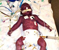 Chương trình mới cho công tác phòng chống sốt xuất huyết trên toàn cầu