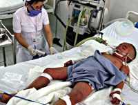 Ca bệnh sốt xuất huyết có nhóm máu Rh (-) cực hiếm ?