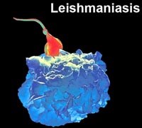 Bệnh ký sinh trùng Leishmaniasis ở da có thể được điều trị bằng liệu pháp nhiệt