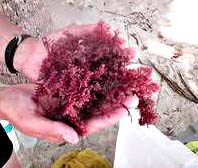 Vũ khí mới chống bệnh sốt rét