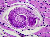 Bộ gen của ký sinh trùng gây bệnh giun xoắn (Trichinosis) đã được giải mã