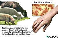 Bệnh than với nỗi lo vũ khí sinh học và căn bệnh nhiễm khuẩn nguy hiểm ở người