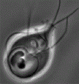 Bệnh đường ruột do trùng roi thìa Giardia intestinalis