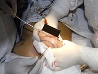 Điểm báo về các thông tin liên quan đến y tế ngày 30 & 31 tháng 3 năm 2011