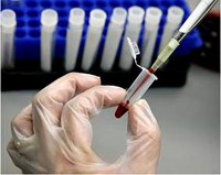 Các yếu tố ảnh hưởng đến kết quả xét nghiệm huyết học, hóa sinh và vi sinh học