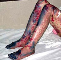 Những mối nguy cơ tiềm ẩn về phản ứng thuốc và hóa chất độc hại đối với cơ thể con người