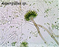 Người suy giảm miễn dịch bị bệnh nặng khi nhiễm nấm Aspergillus
