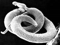 FOLOTAC Technique-một kỹ thuật xét nghiệm trứng giun ở phân người đầy triển vọng 