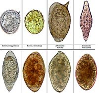 Những trường hợp điển hình về sán lá gan lớn ký sinh lạc chủ ở người