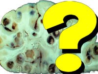 Trả lời câu hỏi bạn đọc về các bệnh liên quan đến ký sinh trùng tháng 5-6 năm 2011