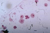 Bộ nhiễm sắc thể giới tính của muỗi An. minimus v An. dirus với dấu hiệu di truyền trong phân loại loài