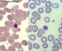 Tại sao ký sinh trùng sốt rét Plasmodium malariae phát hiện chủ yếu tại Khánh Hòa ?