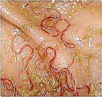 Mối nguy cơ của nhân loại trước tình trạng vi khuẩn, vi rút và ký sinh trùng kháng thuốc ngày càng lan rộng