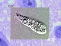 Amíp Naegleria fowleri “ăn não người” là loại ký sinh trùng gì ?