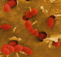 Hướng dẫn chẩn đoán và điều trị bệnh liên cầu lợn ở người