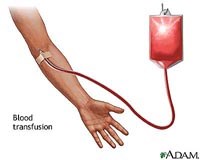 Sàng lọc máu để bảo đảm an toàn truyền máu