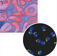 Đích tác động mới-cơ hội ra đời thuốc mới điều trị sốt rét do Plasmodium falciparum