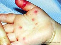 Điểm báo về các thông tin liên quan đến y tế từ ngày 30/9 đến 3/10 năm 2011