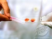 Cần chú trọng “chuẩn vàng trong chẩn đoán sốt rét” tại các điểm kính hiển vi