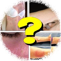 Trả lời câu hỏi bạn đọc về chuyên ngành sốt rét, ký sinh trùng & côn trùng y học tháng 8-9 năm 2011