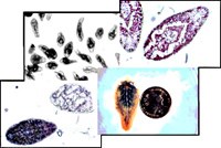 Tiêu chuẩn chẩn đoán của Tổ chức Y tế thế giới về bệnh sán lá gan lớn ở người và ứng dụng xác định ca bệnh