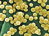 Cảnh báo “siêu vi khuẩn” nguy hiểm