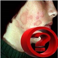 Trả lời câu hỏi bạn đọc về chuyên ngành sốt rét, ký sinh trùng và côn trùng tháng 10 năm 2011