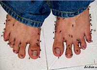 Muỗi “thích” nhất chân bẩn