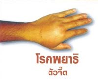 Cơ sở y học chứng cứ để chẩn đoán và xử trí bệnh ấu trùng giun đầu gai 