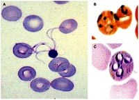 Một người Mỹ nhiễm ký sinh trùng sốt rét khỉ sau chuyến du lịch