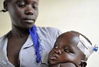 Đề phòng bội nhiễm do sốt rét ác tính