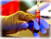 Điểm báo về các thông tin liên quan đến y tế ngày 3/4 năm 2012