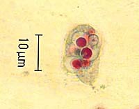Loại amíp sinh sống ở trong miệng