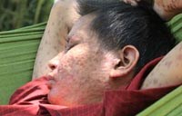 Điểm báo về các thông tin liên quan đến y tế từ 22/6 đến 25/6 năm 2012