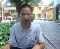 Điểm báo về các thông tin liên quan đến y tế từ ngày 11/7 đến 12/7 năm 2012