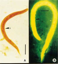 Hiểu biết về bệnh ký sinh trùng đang nổi ở người ấu trùng giun lươn Strongyloides stercoralis